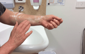 Apply liquid soap onto access arm