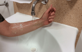 Wet access arm after hand wash